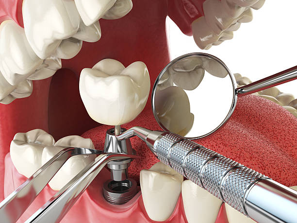 Best Emergency TMJ Treatment in Keshena, WI
